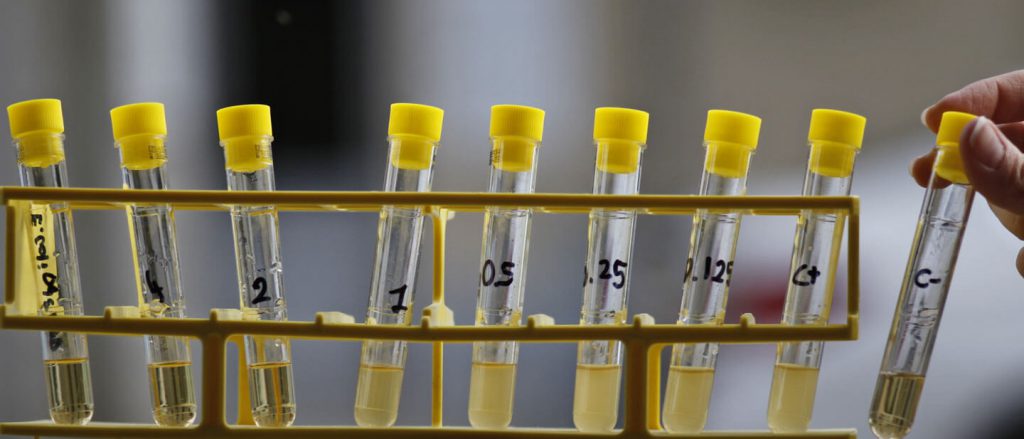 Master di II livello in Diagnostica Microbiologica Avanzata